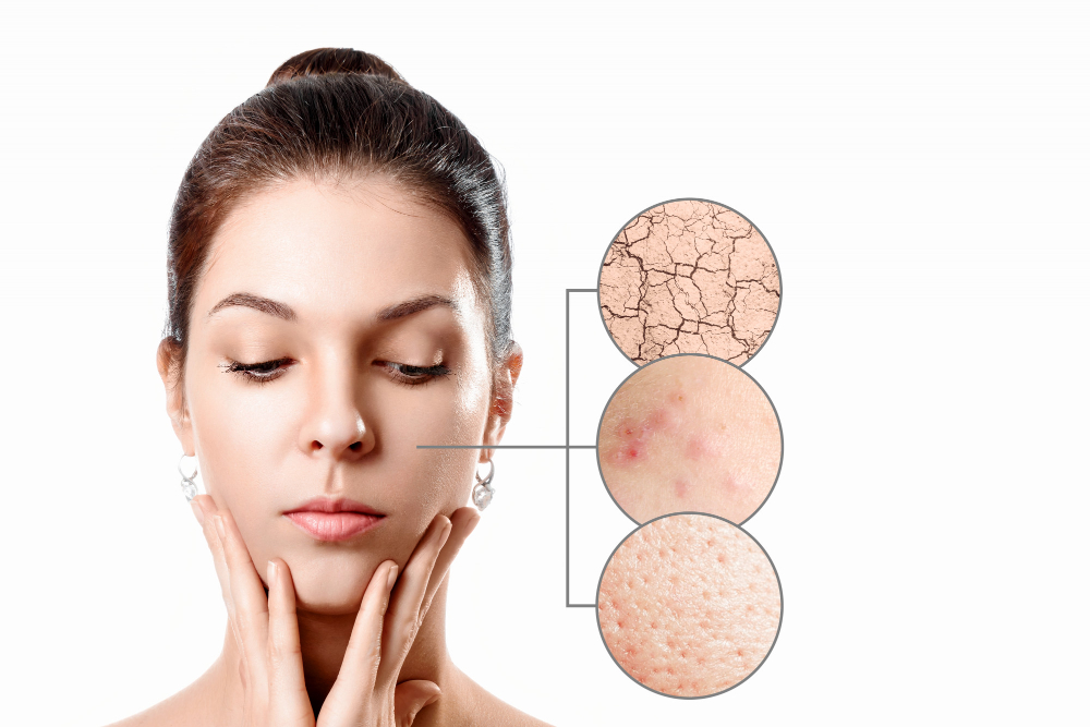 Các bước skincare cho da hỗn hợp