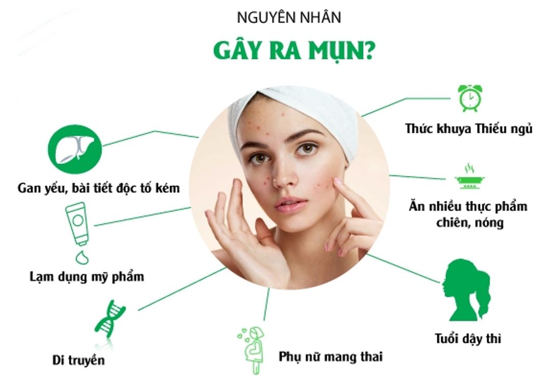 Nguyên nhân gây mụn là gì