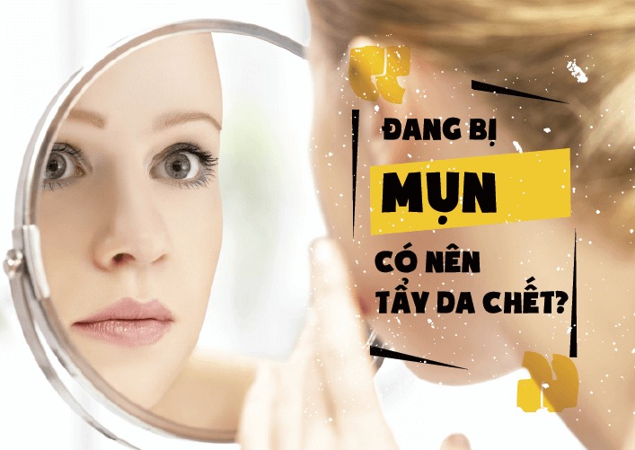 Da mụn có nên tẩy tế bào chết