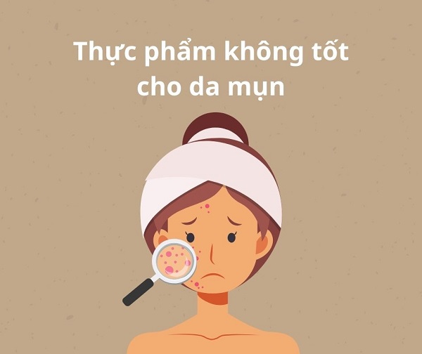 Thực phẩm không tốt cho da mụn