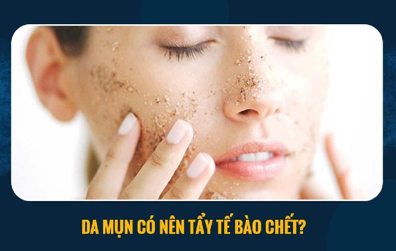 Da mụn vẫn nên tẩy tế bào chết