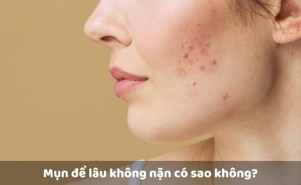 Tình trạng mụn