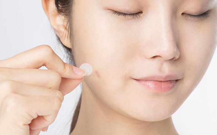 Dùng miếng dán mụn